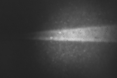 激光诱导荧光成像