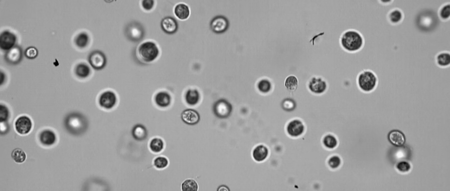 观测细菌鞭毛游动