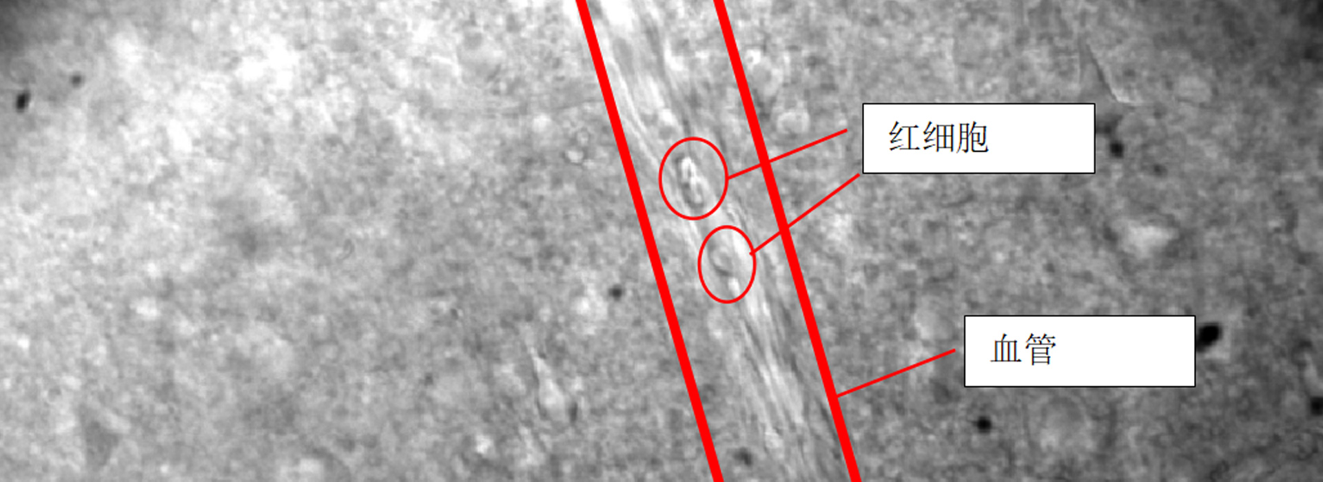 神经元膜片钳实验观测